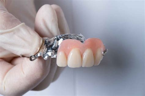 FAQs About Chrome Dentures