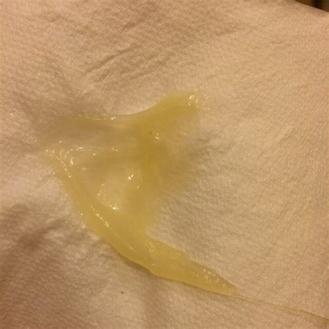 Mucus plug....... 40 weeks today, lost this, have slight cramps, how ...