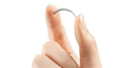 Permanent Birth Control Coil Pulled From Non-US Markets | Clinical And Molecular Dx