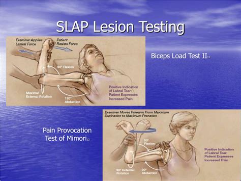 PPT - A Proposed Evidence Based Shoulder Special Testing Examination Algorithm: Adaptation of a ...