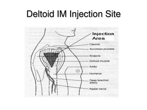 Deltoid Muscle IM Injection