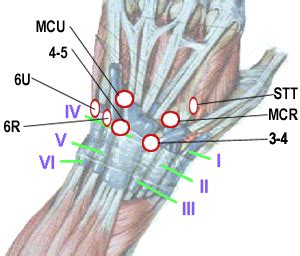 Wrist Arthroscopy - Hand - Orthobullets