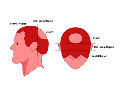 The 4 Regions of the Scalp | Keeps