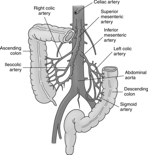 Visceral Angiography | Radiology Key