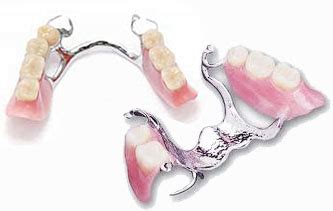 metal frame denture design - americancruisercampervan