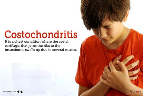 Costochondritis: Symptoms, Causes, Treatment, Cost, and Side Effects (2022)