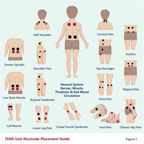 What Is the Best Tens Unit for Lower Back Pain