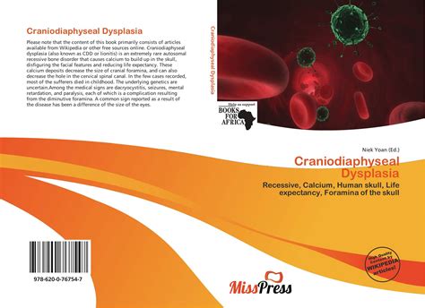 Craniodiaphyseal Dysplasia, 978-620-0-76754-7, 6200767548 ,9786200767547