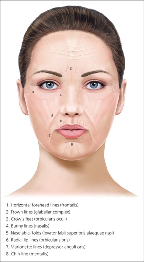 Botulinum Toxin Injection for Facial Wrinkles | AAFP