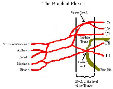 Supraclavicular Block