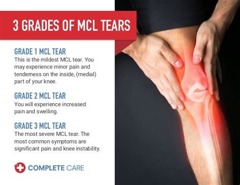 Torn Mcl Treatment | Minimalis