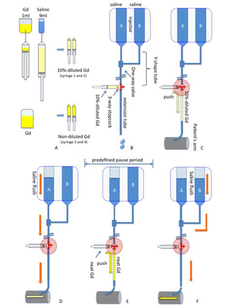 Preparation of the dual-bolus injection scheme for injectors with a ...