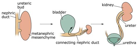 Duplex kidney formation: developmental mechanisms... | F1000Research