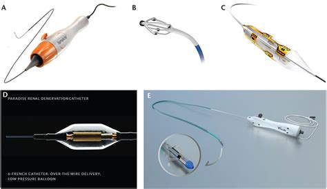 Renal Denervation: Past, Present, and Future