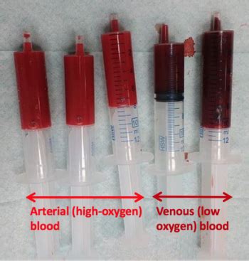 Chapter 5: THE CARDIOVASCULAR SYSTEM: BLOOD – Anatomy & Physiology