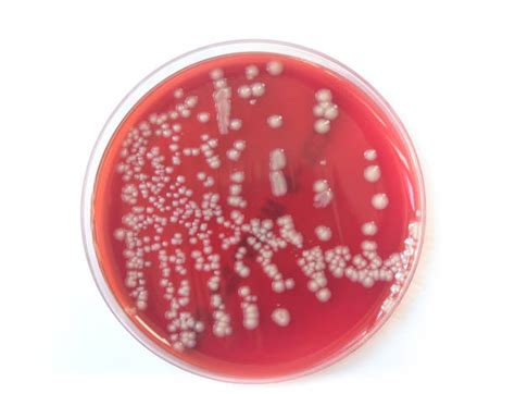 Blood Agar Plates Stock Photos, Pictures & Royalty-Free Images - iStock