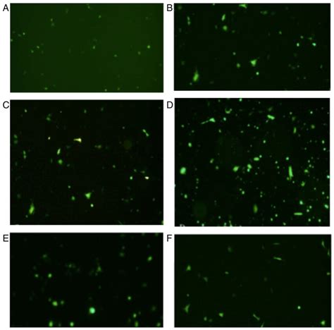 Fluorescent protein expression investigated using fluorescence ...