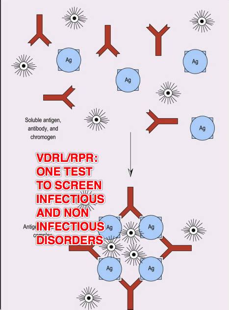 False positive VDRL/RPR test: Rule out Antiphospholipid syndrome