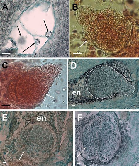 Development of the endosperm and embryos after crossing. a Three-celled... | Download Scientific ...