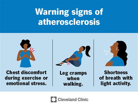 Atherosclerosis: Symptoms & Treatment