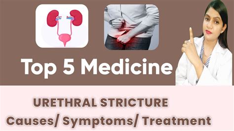 Urethral Stricture Causes Symptoms Diagnosis Urethral