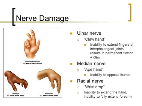 Pin on peripheral nerve | Median nerve, Radial nerve, Physical therapist assistant