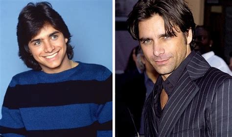 John Stamos Before and After Plastic Surgery: Facelift, Botox