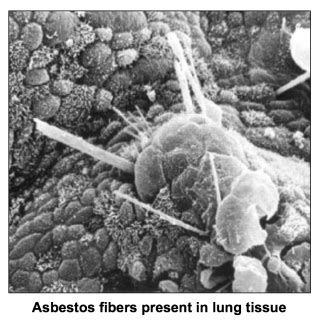 Asbestos Fibers Under Microscope