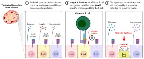 Immune Mediated Diabetes