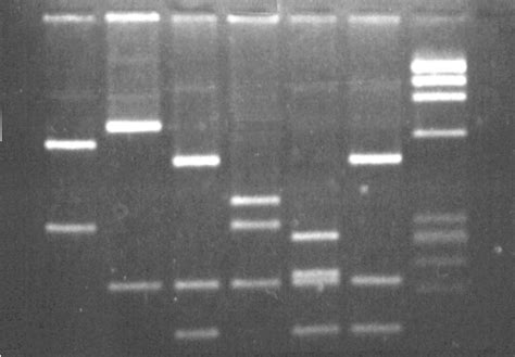 DNA Electrophoresis