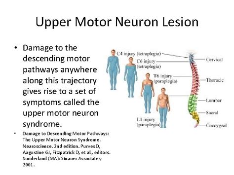 Evaluation and Management of Spinal Cord Emergency and