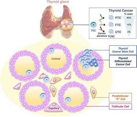 Parafollicular Cell Of Thyroid