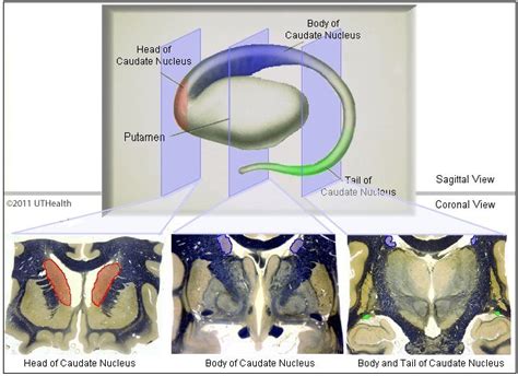 Neuroanatomy Online: Lab 2 - Internal Organization of the Brain - Caudate Nucleus