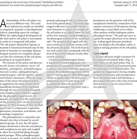 Defect in the soft palate of a 26-year-old man. Fig. 2. Defect in the ...