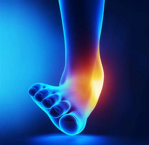 5 Signs of an Ankle Sprain | Podiatrist located in Fort Worth, TX ...