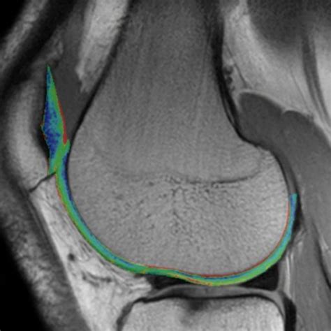 Orthopaedic (MSK) MRI - Charter Radiology