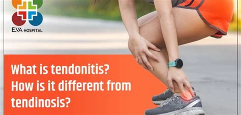 What is Tendonitis? How is it Different from Tendinosis? - Eva Hospital