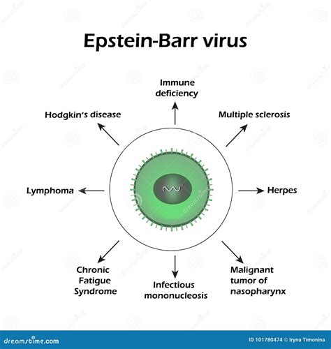 Epstein-Barr Virus. Diseases Caused by a Virus. Infographics Stock Vector - Illustration of ...