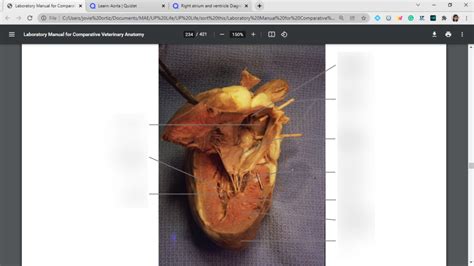 Left atrium and ventricle Diagram | Quizlet