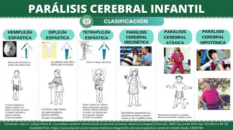 Paralisis Cerebral Infantil Paralisis Cerebral Infantil | The Best Porn Website