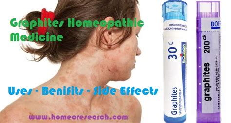 Homeopathic Graphites Benefits or Uses for Eczema and Side effects ...