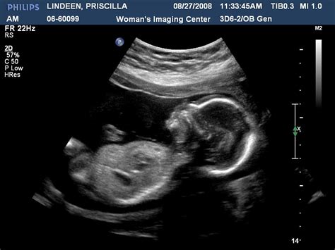 It's a boy - Ultrasound @20 weeks | Due date Jan. 16th | Priscilla | Flickr