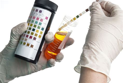 Dipstick Urinalysis Definition at Eugene Johnson blog