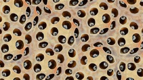 Trypophobia Penyakit Atau Bukan - Homecare24