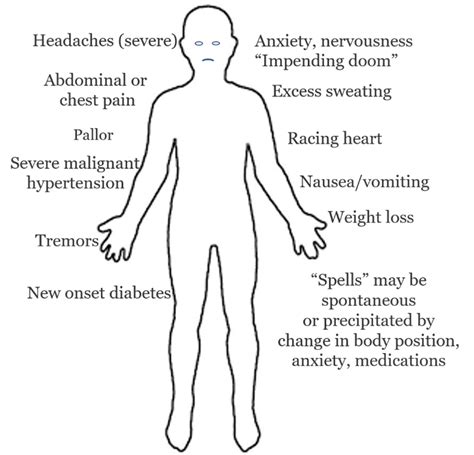 Top 5 Symptoms of Adrenal Pheochromocytoma