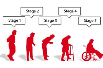 Stages of Parkinson's disease | Stem Cell Therapy, Bangalore