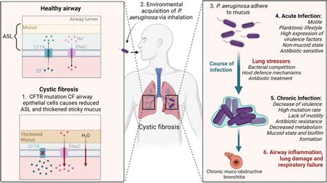 Frontiers | To bead or not to bead: A review of Pseudomonas aeruginosa lung infection models for ...