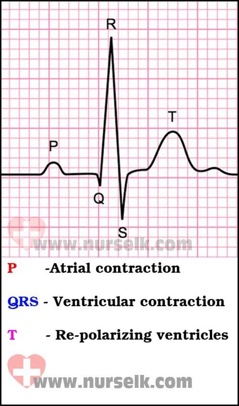 Ekg Labeled