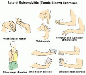 5 At Home Exercises For Tennis Elbow (Lateral Epicondylitis)