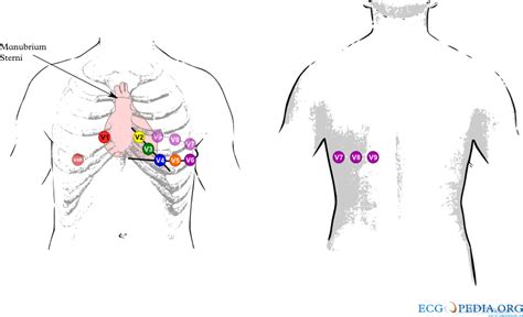 File:Leads 789.png - ECGpedia